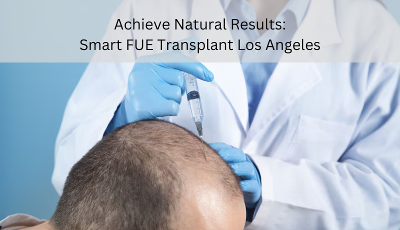 smart FUE transplant Los Angeles